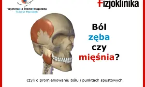 Model czaszki z zaznaczonym mięśniem skroniowym. Czy to ból zęba czy mięśnia? Fizjoterapia stomatologiczna.