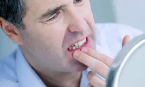 Mężczyzna bada usta w lustrze, zastanawiając się, jaka witamina na afty może pomóc.