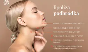 Kobieta z zaznaczonym obszarem podbródka, gdzie lipoliza poprawia kontur, redukuje drugi podbródek i wysmukla dolną część twarzy.