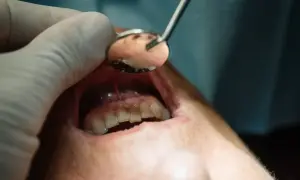 Badne objawy ropnia mózgu od zęba mogą być subtelne. Dentysta bada jamę ustną, szukając przyczyn problemów.