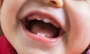 Uśmiechnięte niemowlę z widocznymi pierwszymi ząbkami. Wczesne ząbkowanie u niemowląt to ważny etap rozwoju.