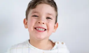 Uśmiechnięty chłopiec z widocznymi zębami. Czy szóstki to zęby mleczne? Jego uśmiech jest pełen radości.