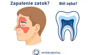 Zapalenie zatok czy ból zęba? Ilustracja porównuje objawy zapalenia zatok z bólem policzka u dziecka, który może być związany z problemami stomatologicznymi.