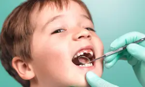 Chłopiec z uśmiechem pokazuje ząbki, kiedy wypadają mleczaki. Dentysta w zielonej rękawiczce bada jego usta lusterkiem.