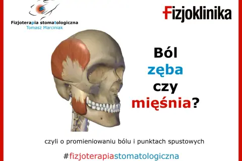 Model czaszki z zaznaczonym mięśniem skroniowym. Czy to ból zęba czy mięśnia? Fizjoterapia stomatologiczna.