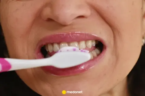 Kobieta myje zęby białą szczoteczką z różowym akcentem i pianą. Dobra szczoteczka to podstawa higieny.