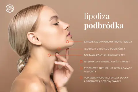 Kobieta z zaznaczonym obszarem podbródka, gdzie lipoliza poprawia kontur, redukuje drugi podbródek i wysmukla dolną część twarzy.
