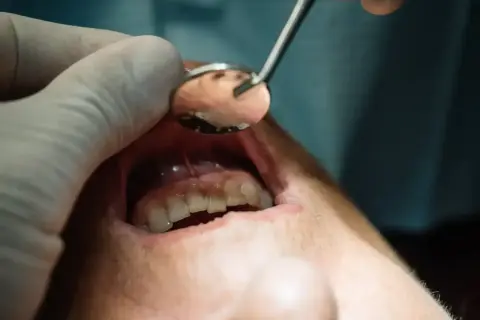 Badne objawy ropnia mózgu od zęba mogą być subtelne. Dentysta bada jamę ustną, szukając przyczyn problemów.