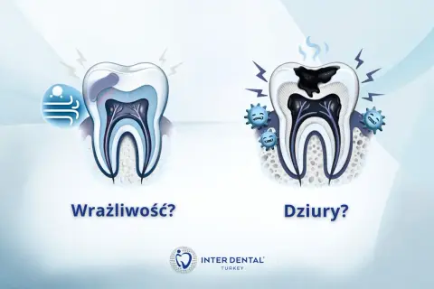 Wrażliwość zębów? Ciągły ból? Zobacz, jak próchnica niszczy ząb, powodując ból i dziury.