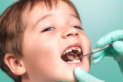 Chłopiec z uśmiechem pokazuje ząbki, kiedy wypadają mleczaki. Dentysta w zielonej rękawiczce bada jego usta lusterkiem.