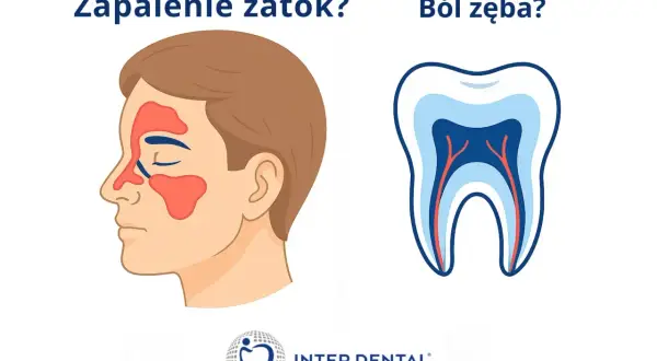 Zapalenie zatok czy ból zęba? Ilustracja porównuje objawy zapalenia zatok z bólem policzka u dziecka, który może być związany z problemami stomatologicznymi.