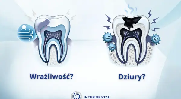 Wrażliwość zębów? Ciągły ból? Zobacz, jak próchnica niszczy ząb, powodując ból i dziury.