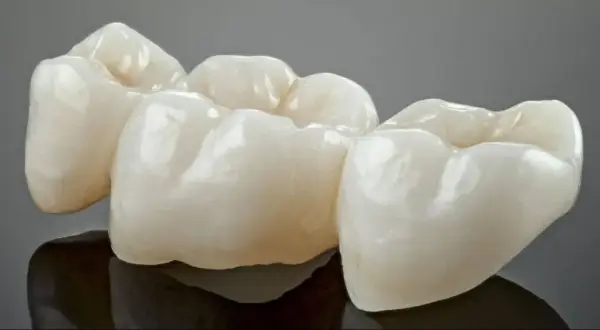 Trzy ceramiczne korony, gotowe do rekonstrukcji zęba, lśnią na ciemnym tle.