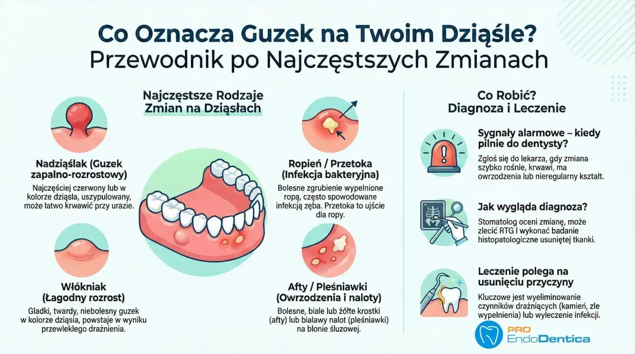 Ilustracja przedstawia ropień, czyli przetokę na dziąśle, która jest bolesnym zgrubieniem wypełnionym ropą, często spowodowanym infekcją zęba.