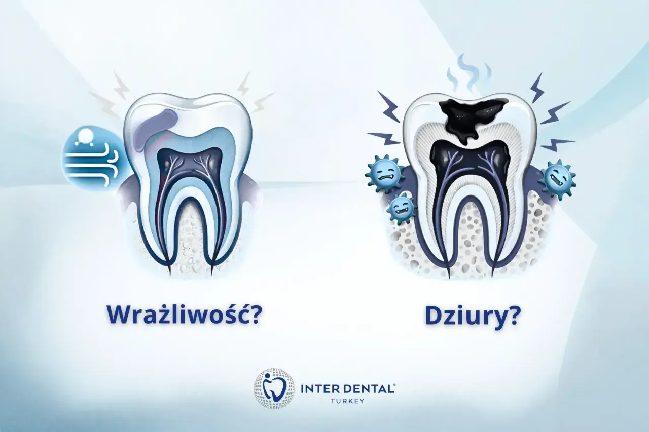 Wrażliwość zębów? Ciągły ból? Zobacz, jak próchnica niszczy ząb, powodując ból i dziury.