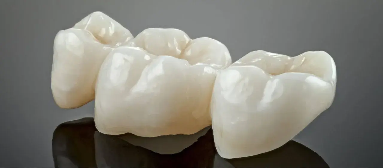 Trzy ceramiczne korony, gotowe do rekonstrukcji zęba, lśnią na ciemnym tle.