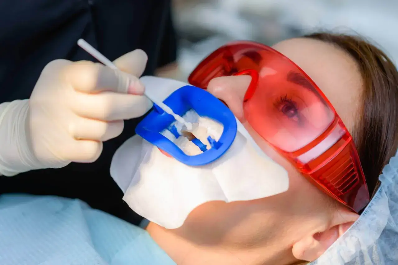 Dentysta aplikuje żel do fluoryzacji zębów. Pacjent ma założone okulary ochronne.