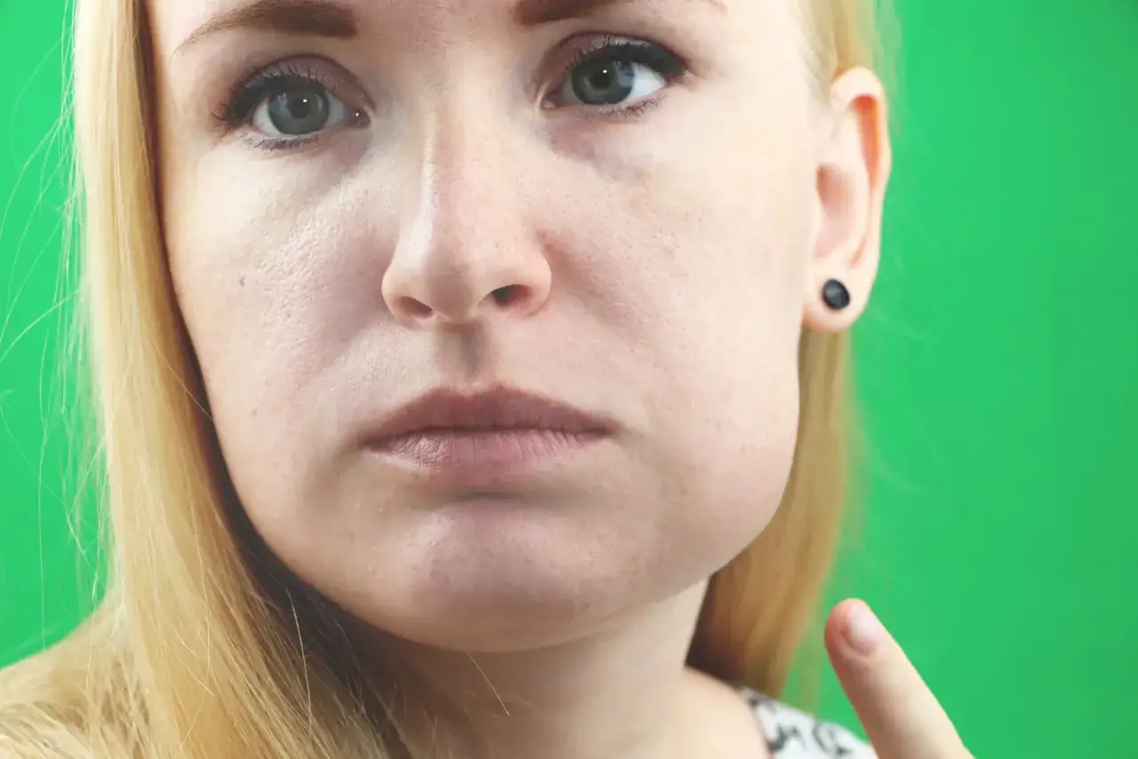 Obrzęk policzka wskazuje na nieleczony stan zapalny zęba. Kobieta pokazuje palcem opuchnięte miejsce.