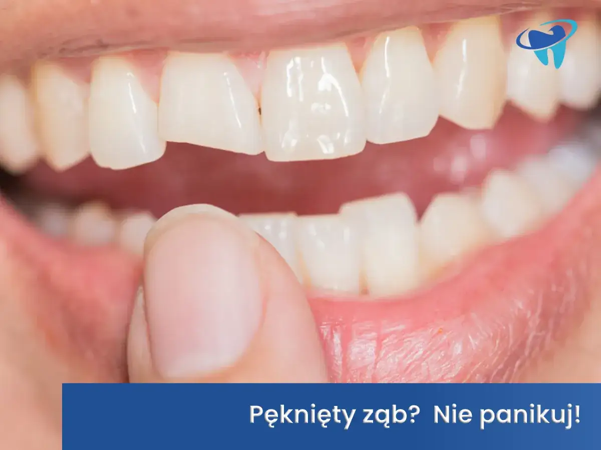 Pęknięty ząb? Nie panikuj! Palec wskazujący dotyka przedniego zęba, który ma widoczne pęknięcie.