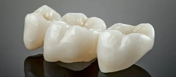 Trzy ceramiczne korony, gotowe do rekonstrukcji zęba, lśnią na ciemnym tle.